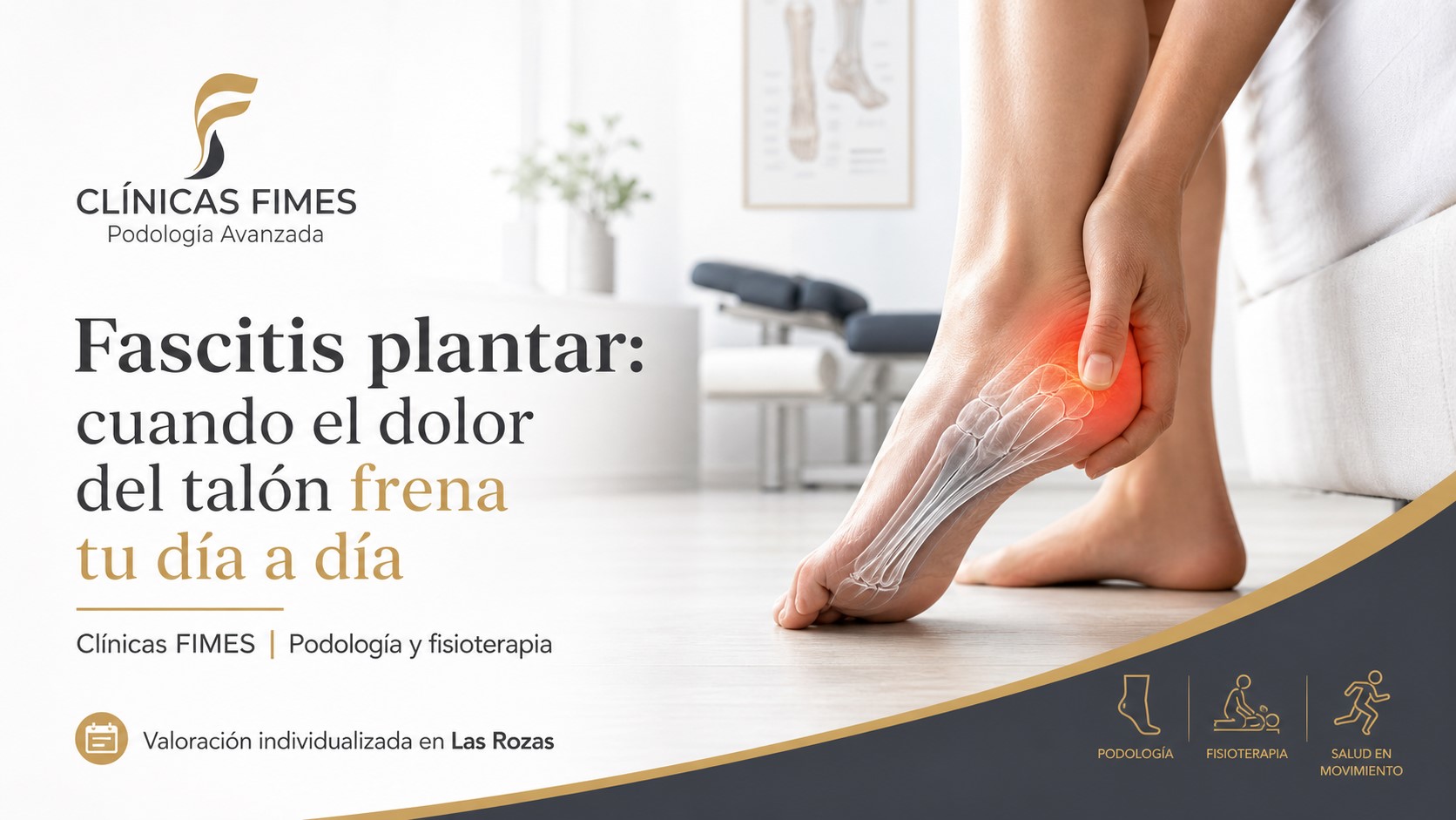 Fascitis Plantar: Tratamientos y Soluciones en Las Rozas